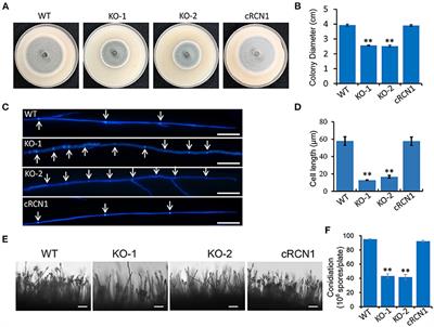 A Calcineurin Regulator MoRCN1 Is Important for Asexual Development, Stress Response, and Plant Infection of Magnaporthe oryzae